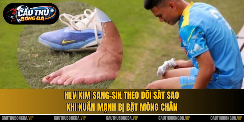HLV Kim Sang-sik theo dõi sát sao khi Xuân Mạnh bị bật móng chân